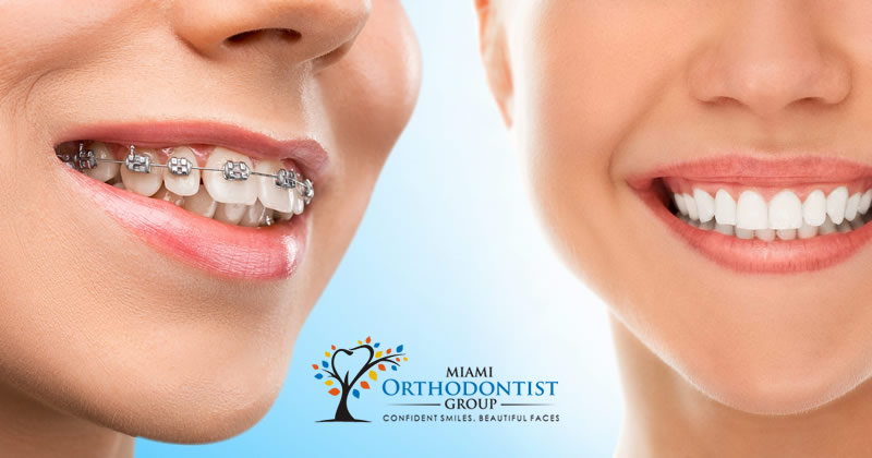 The 7-Second Trick For Orthodontics