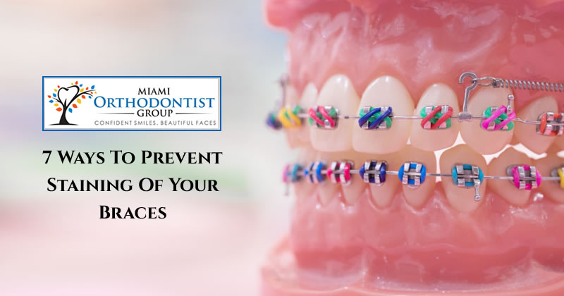 7 Ways To Prevent Staining Of Your Braces