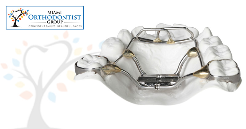Why Orthodontic Appliances Are Ideal At Any Age