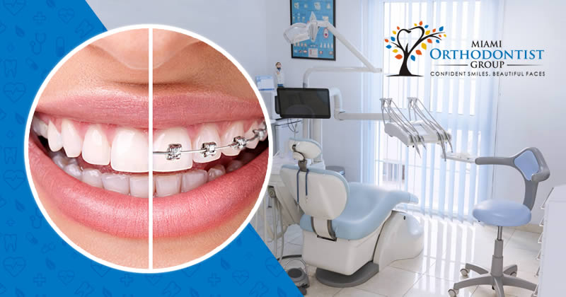 How Invisalign Treatment Is Better Than Traditional Braces