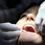 Botox In Dentistry