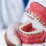 how do orthodontists treat bite alignment