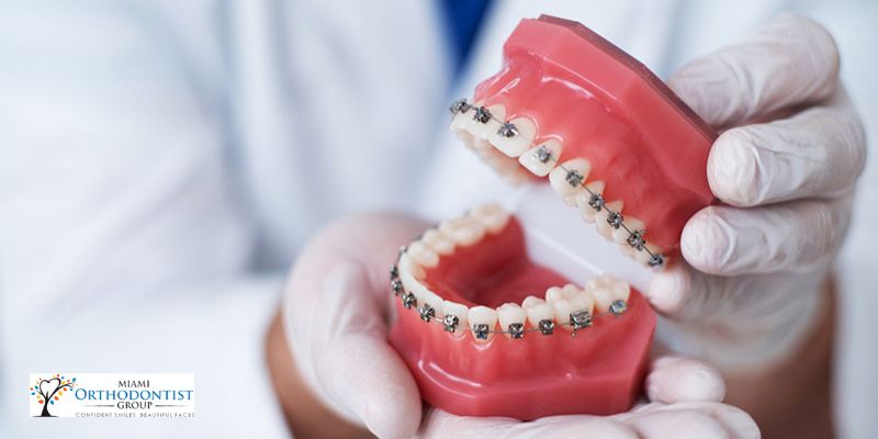 how do orthodontists treat bite alignment
