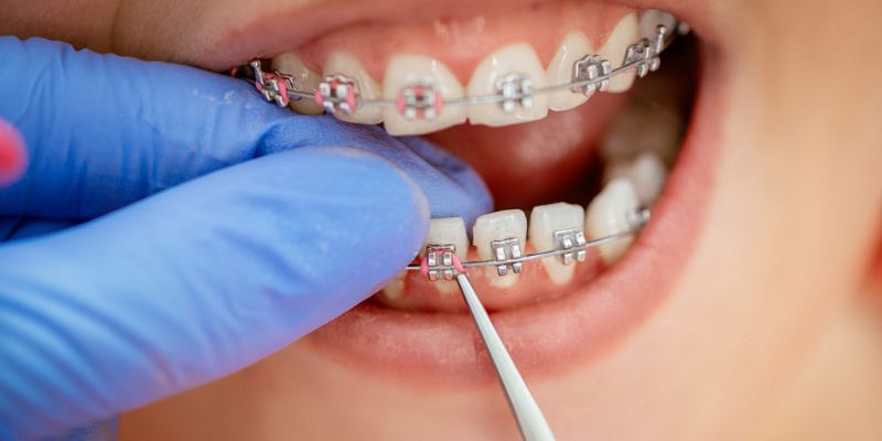 Benefits of Dentofacial Orthopedics
