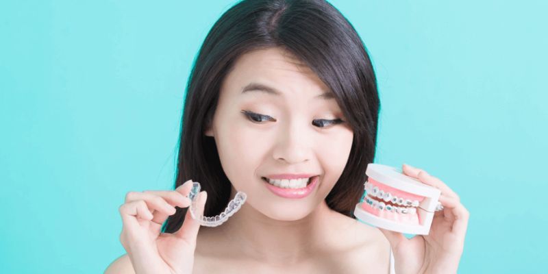 clear braces and aligners