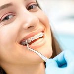 The Importance of Bite Alignment in Orthodontic Treatment