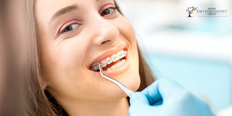 The Importance of Bite Alignment in Orthodontic Treatment