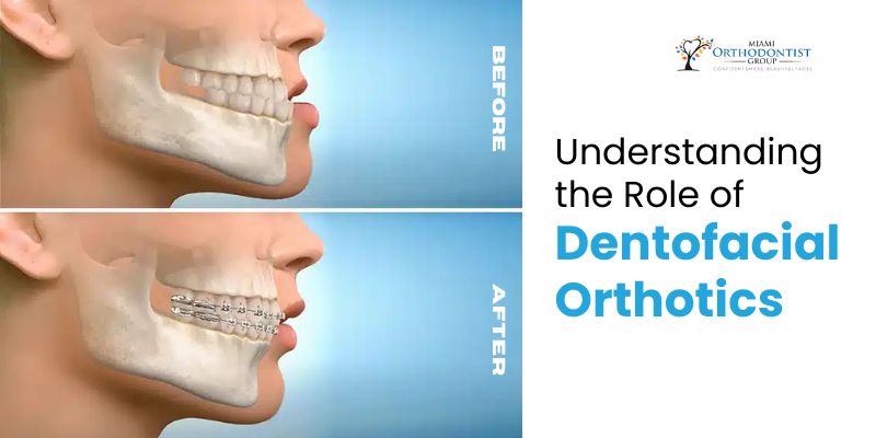 Dentofacial Orthotics